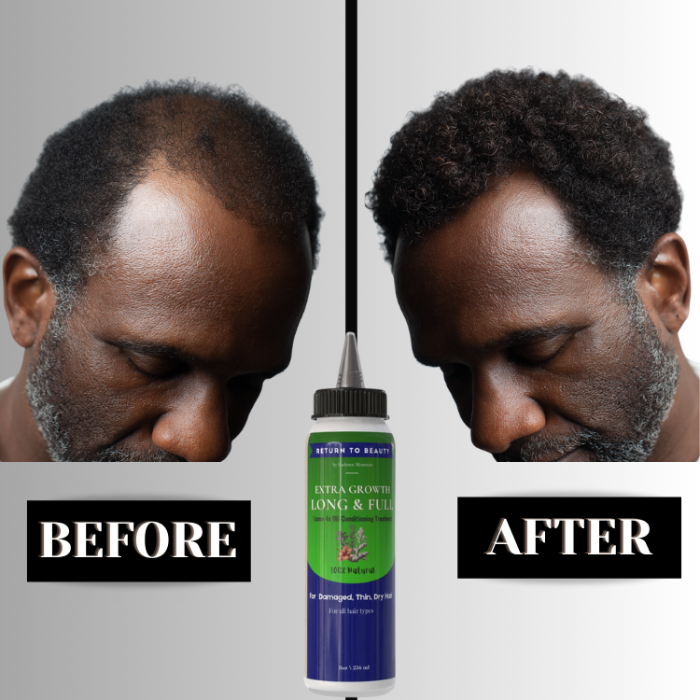 Hair Extra Growth Long & Full Treatment Oil (4C, 4B, 4A Hair)